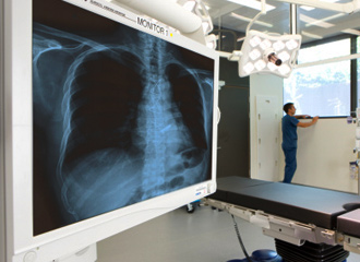 photo of chest xray